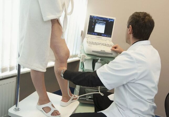 Diagnosis of varicose veins