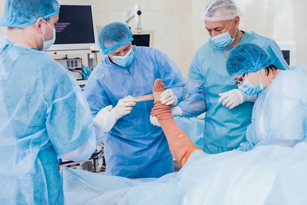 Varicose surgery